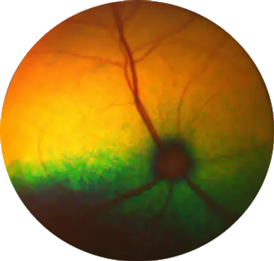 Feline Retina