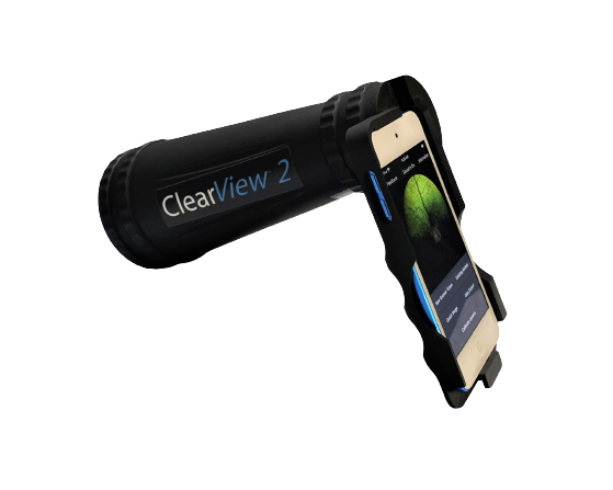Clearview device